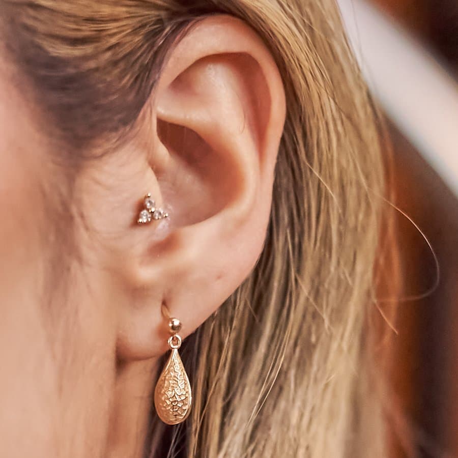 Aretes